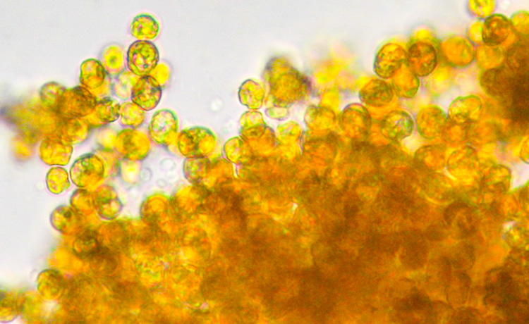 ヒメシャコに共生する褐虫藻の顕微鏡写真。丸い粒状の微細藻類で、直径は0.01mmほど＝高知大学の小野寺健一さん提供
